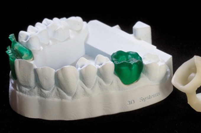 德國率先引入3D打印牙齒技術(shù) 全程體驗“無痛”種牙-e鍵打印|3D打印服務(wù)
3d打印牙齒,3D打印種牙,無痛種牙,3D打印平臺,3D打印服務(wù),南京哪里有3D打印,南京3D打印廠家,南京3D打印服務(wù)