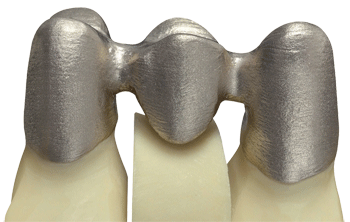 德國率先引入3D打印牙齒技術(shù) 全程體驗“無痛”種牙-e鍵打印|3D打印服務(wù)
3d打印牙齒,3D打印種牙,無痛種牙,3D打印平臺,3D打印服務(wù),南京哪里有3D打印,南京3D打印廠家,南京3D打印服務(wù)