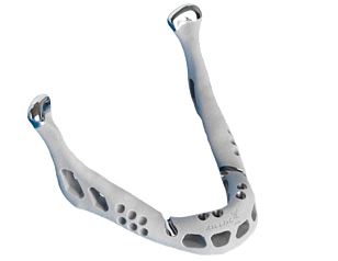 3d打印下頜骨成功移植 置換人體器官不再是夢-e鍵打印|3D打印服務
醫療3d打印技術,3D打印下頜骨,3D打印人體器官,3D打印器官,3D打印心臟,3D打印假肢,3D打印大腦,3D打印技術,3D打印服務,3D打印云平臺