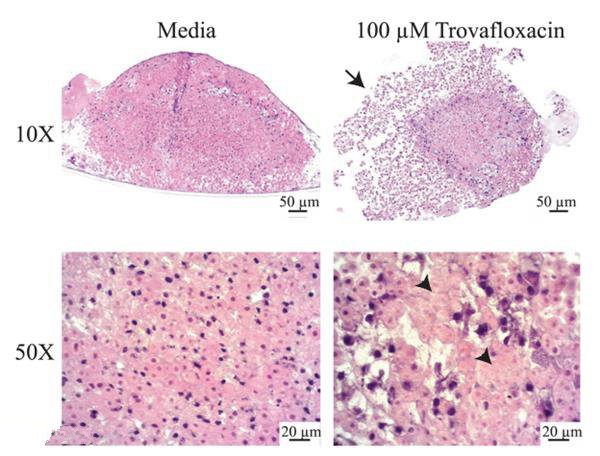 人類活體試驗(yàn)出解決方案 用3D打印的人類肝組織做藥物毒性評(píng)估_e鍵打印服務(wù)