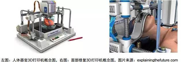 3d打印在醫療領域的應用 3D打印與醫療行業白皮書