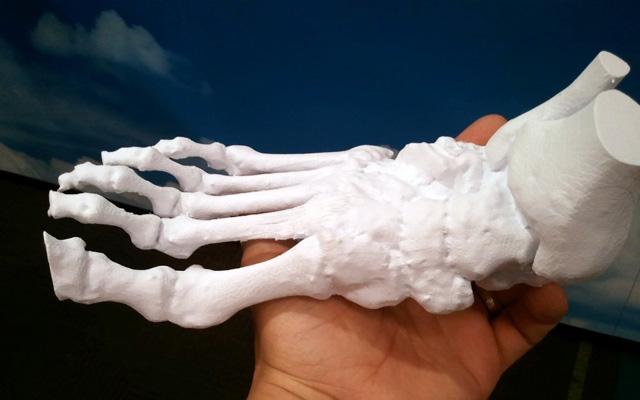 3d打印應用領域之醫療應用_e鍵打印服務公司